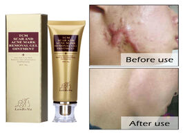 Foto van Schoonheid gezondheid removal of scars and instrument acne mask removing gel ointment lambena skin r