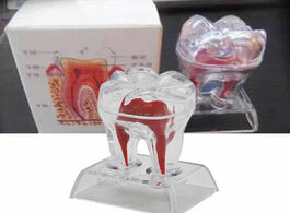Foto van Schoonheid gezondheid dentist dental crystal base hard plastic teeth tooth molar model separable