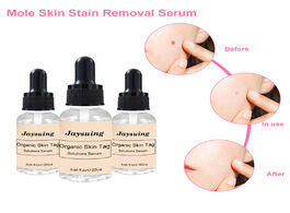 Foto van Schoonheid gezondheid 20ml mole and skin tag remover liquid genital wart treatment papillomas remova