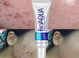 Foto van Schoonheid gezondheid bioaqua acne removal cream gel treatment anti scar whitening face moisturizing