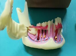 Foto van Schoonheid gezondheid dental endodontic treatment model anatomy of gums study teach teeth