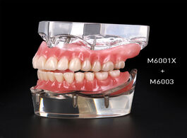 Foto van Schoonheid gezondheid dental implant restoration teeth model removable bridge denture demo disease w