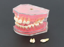 Foto van Schoonheid gezondheid dental standard model with removable teeth 4004 01 study teach