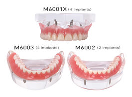 Foto van Schoonheid gezondheid dental implant teeth model removable interior mandibular demo overdenture with