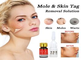 Foto van Baby peuter benodigdheden removal face wart tag freckle cream oil mole skin solution painless dark s