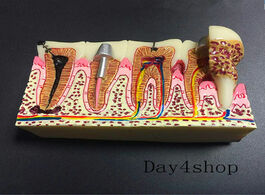 Foto van Schoonheid gezondheid dental anatomy of caries plastic teeth model demonstration communication