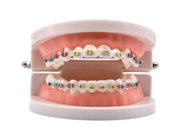 Foto van Schoonheid gezondheid dental orthodontic treatment model with ortho metal ceramic bracket arch wire 