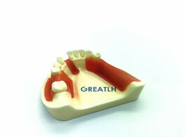 Foto van Schoonheid gezondheid dental lower jaw implant practice model gingiva with missing teeth dentist edu